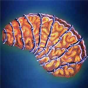 Download Various - Brain In The Wire - Disc A