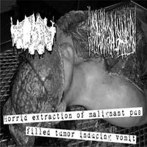 Download V.O.M.I.T. / Horrid Visceral Extraction - Horrid Extraction Of Malignant Pus Filled Tumour Inducing Vomit