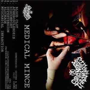 Download Coronary Thrombosis - Medical Mince