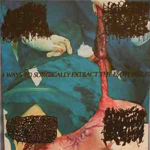 Download Autopsy Festival, Liquified Organ Catheter, Infected Bloated Lung, Vomiting Through An Infected Tracheotomy - 4 Ways To Surgically Extract The Esophagus