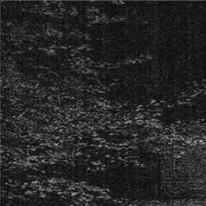 Download Vestibulum Vacuüi, Mental Decay - Vestibulum Vacuüi / Mental Decay