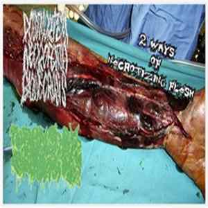 Download Postmortem Neurofetish Bionecrosis / Forensick Entomology - 2 Ways of Necrotizing Flesh