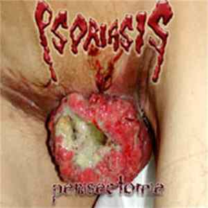 Download Psoriasis - Penisectomie