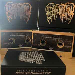 Download Epicardiectomy - Relics From Malodorous Pile