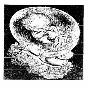 Download Placenta Lyposuction - Wrath Of The Womb