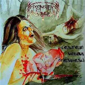 Download Postmorten - Cesarean Without Anesthesia