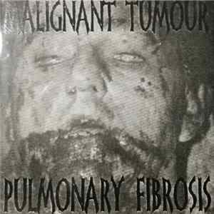 Download Malignant Tumour / Pulmonary Fibrosis - Grinding Party !!!